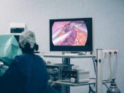 Fibroscopie gastrique