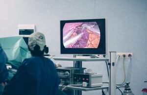 Fibroscopie gastrique