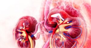 Urographie intraveineuse