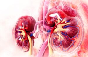 Urographie intraveineuse