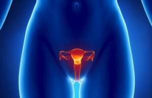 Colposcopie : quand, comment, prix, on vous explique