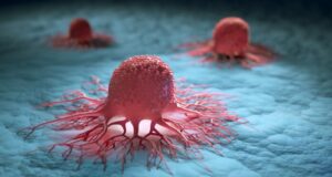 Diagnostic d’un cancer