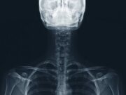 Examen rhumatologique