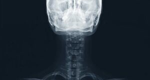 Examen rhumatologique