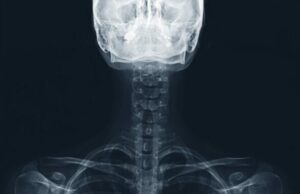 Examen rhumatologique