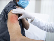 Covid-19 : tous les effets indésirables, vaccin par vaccin