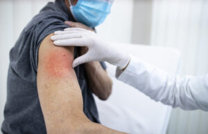 Covid-19 : tous les effets indésirables, vaccin par vaccin