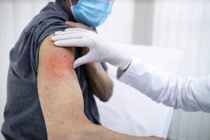 Covid-19 : tous les effets indésirables, vaccin par vaccin