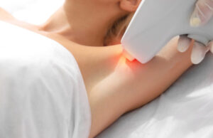 Beauté : l’épilation à la lumière pulsée autorisée en France