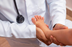 Covid-19 : Le symptôme des orteils bleus