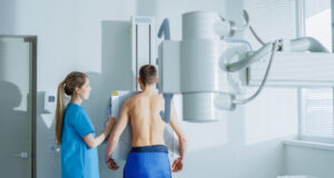 Cancer du poumon: un dépistage généralisé à tous les fumeurs