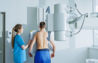 Cancer du poumon: un dépistage généralisé à tous les fumeurs