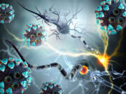 Covid-19 : séquelles neurologiques de type Alzheimer