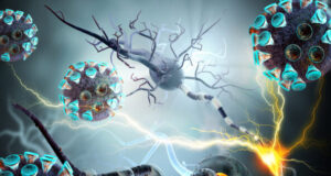 Covid-19 : séquelles neurologiques de type Alzheimer