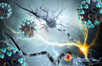 Covid-19 : séquelles neurologiques de type Alzheimer