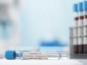 Covid-19 : le nombre des nouvelles contaminations ne baissent plus