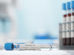 Covid-19 : le nombre des nouvelles contaminations ne baissent plus