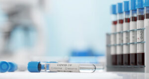 Covid-19 : le nombre des nouvelles contaminations ne baissent plus
