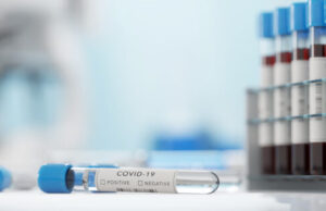 Covid-19 : le nombre des nouvelles contaminations ne baissent plus