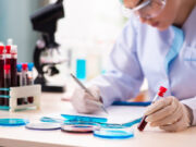 Pourquoi les scientifiques s’inquiètent des microplastiques présents dans le sang ?