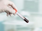 Grossesse: comment comprendre le résultat de la prise de sang