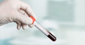 Grossesse: comment comprendre le résultat de la prise de sang