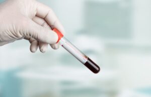 Grossesse: comment comprendre le résultat de la prise de sang