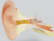 Mon cerumen est noir : est-ce normal ?