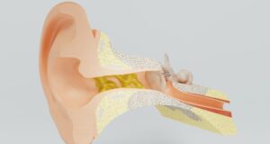 Mon cerumen est noir : est-ce normal ?