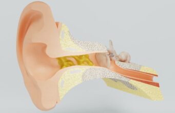 Mon cerumen est noir : est-ce normal ?