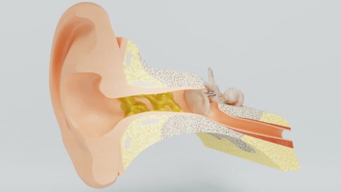 Mon cerumen est noir : est-ce normal ?