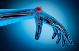 Les ganglions médiastinaux : qu’est ce que c’est?