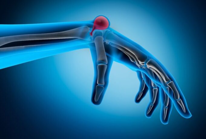 Les ganglions médiastinaux : qu’est ce que c’est?