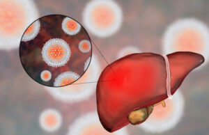 Hépatite d’origine inconnue : 2 cas à Lyon
