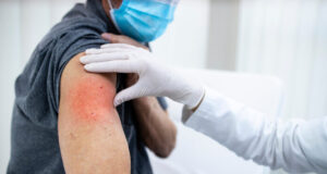 Covid et vaccins ARN : 125.000 effets indésirables