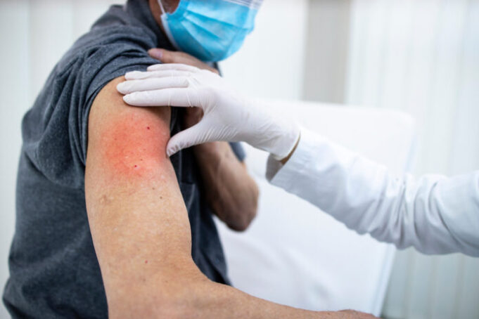 Covid et vaccins ARN : 125.000 effets indésirables