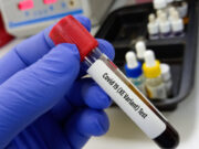 Covid : le variant XE est inquiétant