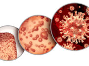 Un cas confirmé en France de variole du singe : pourquoi c’est inquiétant ?