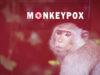 Variole du singe : risque de pandémie ?