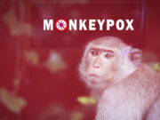 Variole du singe : risque de pandémie ?