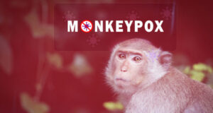 Variole du singe : risque de pandémie ?