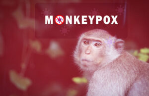 Variole du singe : risque de pandémie ?