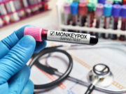 Variole du singe : «la situation évolue très rapidement»