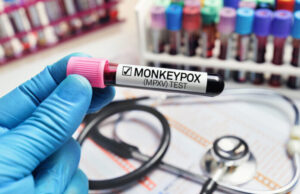 Variole du singe : «la situation évolue très rapidement»