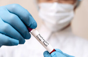 Variole du singe : un décès confirmé par l’OMS