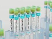 Variole du singe : l’OMS appelle à l’action «urgente»