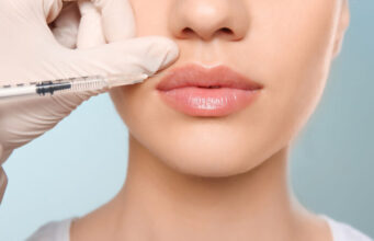 Esthétique : des lèvres pulpeuses à quel prix ?