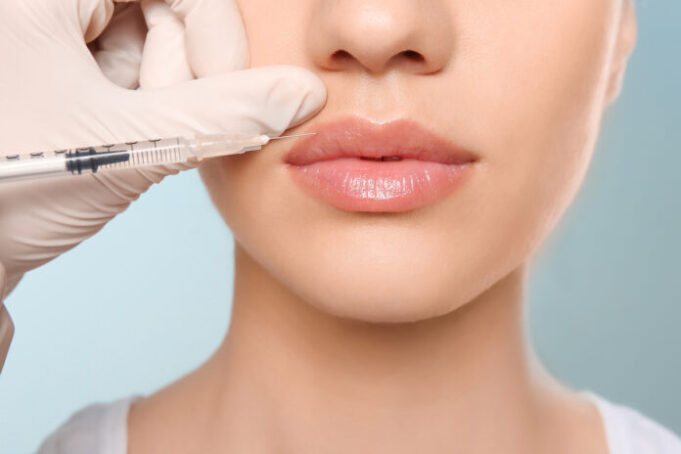Esthétique : des lèvres pulpeuses à quel prix ?
