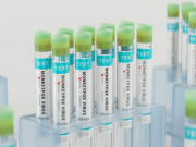 Variole du singe : les tests de détection bientôt remboursés