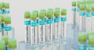 Variole du singe : les tests de détection bientôt remboursés